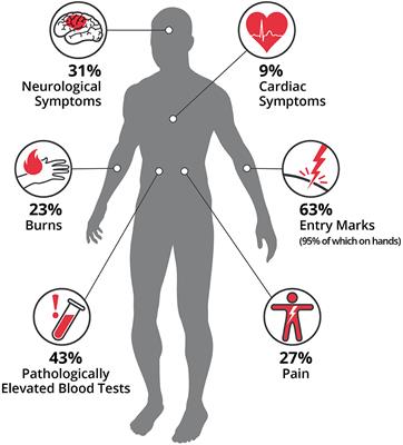 International Multi-Center Analysis of In-hospital Morbidity and Mortality of <mark class="highlighted">Low-Voltage</mark> Electrical Injuries